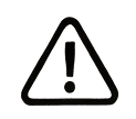 Warning triangle with exclamation mark symbol.